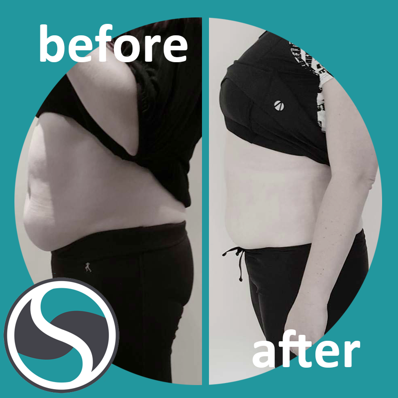 ShapeSculptors's tweet photo. #motivationtuesday
We here at shape sculptors love to see the amazing progress of our happy clients! <3 
Just look at this #beforeandafter using our #noninvasive treatment.
The result the fat just starts to melt away!
#fitness #noninvasive #happybodyhappyou #weightloss #treatment https://t.co/bmzSAE0IvH