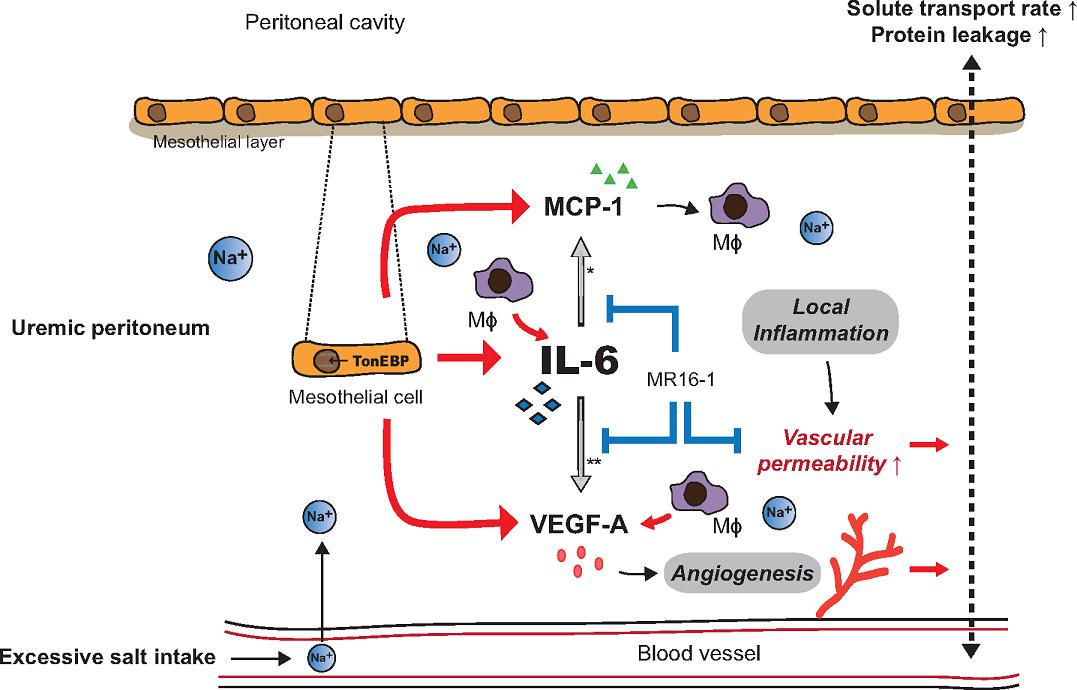 ERAkidney's tweet image. Salt restriction in CKD patients might preserve peritoneal transport function before the initiation of PD. Read the news on ENP! bit.ly/2V1Lygp #kidneydisease #peritonealdialysis #saltintake @NDTsocial