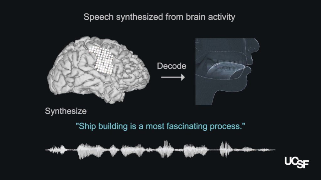 Afflatus28's tweet image. Generation of Synthetic Speech from Neural Decoding #neuraldecoding #speech afflatus.co.in/generation-of-…