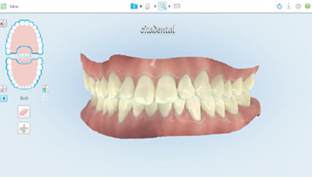 Citadental's tweet photo. Nuestra clínica de Bravo Murillo 154 es la primera en contar con iTero 5D una tecnología de escaneado puntera que nos ofrece muchas ventajas de cara a nuestros pacientes. Te la descubrimos. https://t.co/HcjrBzNIfW #citadental #felizmartes https://t.co/wlFJnSl6Md