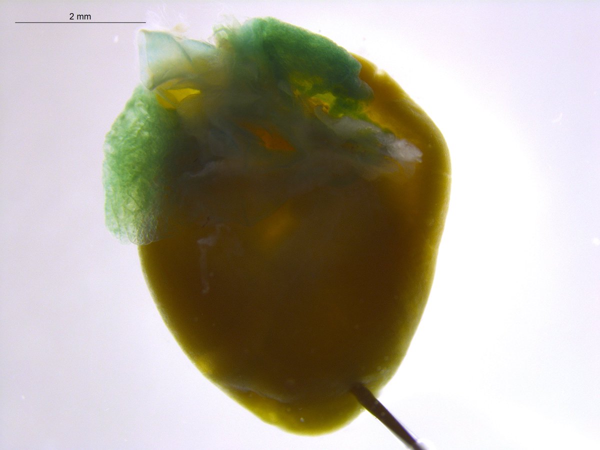 GeneOfTheDay's tweet photo. Today’s #GeneOfTheDay is #Tead1. Human diseases associated with this gene include Sveinsson Chorioretinal Atrophy. Mice with this gene inactivated exhibit abnormal embryo size in females and increased heart weight in males: https://t.co/CYwHa36XUO https://t.co/ynY7mlusgo