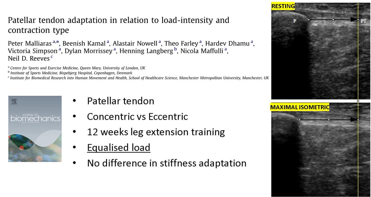 DrPeteMalliaras's tweet photo. Our paper from 2013 demonstrates tendon is responsive to load intensity and does not care what the contraction type is

https://t.co/99YLvAHwKL

@DrDylanM @henninglangberg @PhysioBeen https://t.co/ezYV7au7pM