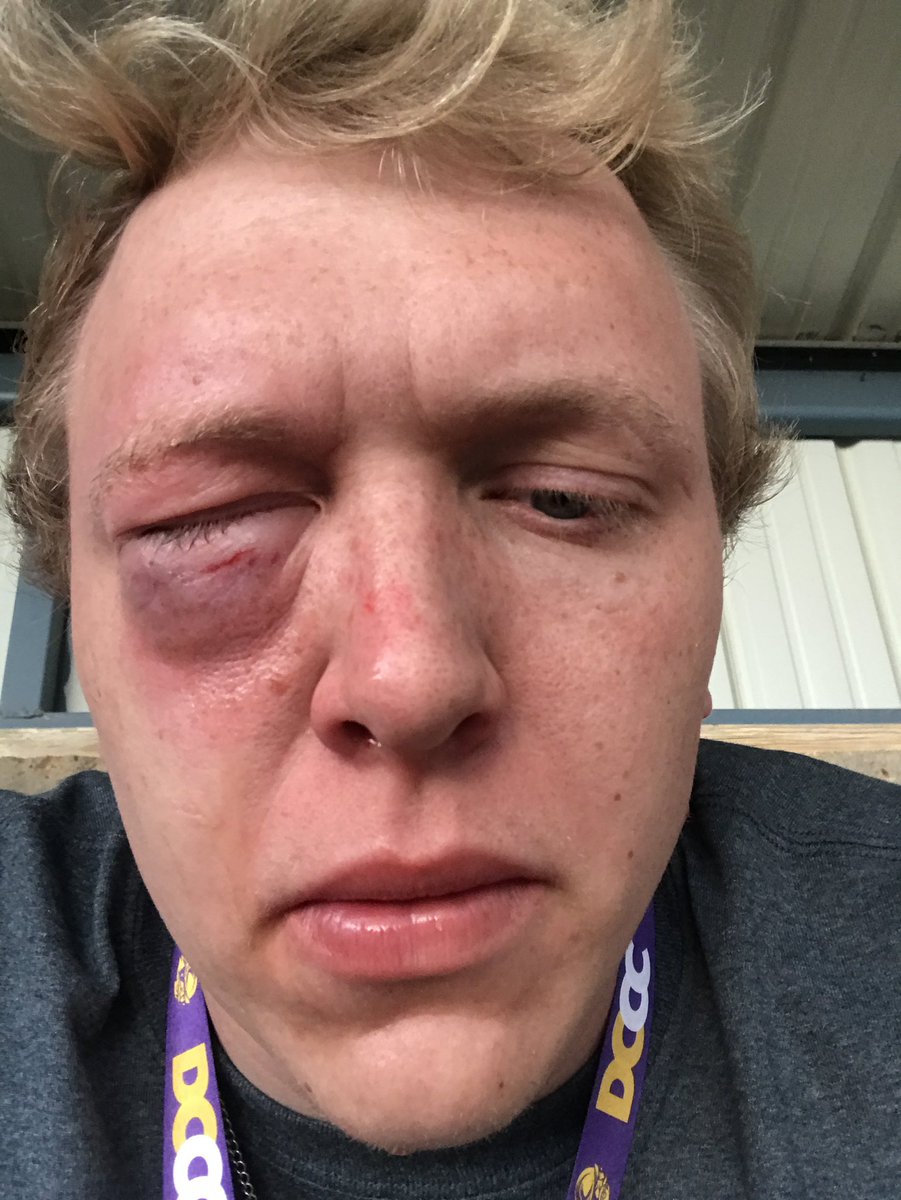 mark_persinger's tweet image. Low key forgot how old @zack_leininger was turning today...accidentally told him happy 20th, but this guy is the big ✌🏼☝🏼 hbd 🥳🎉