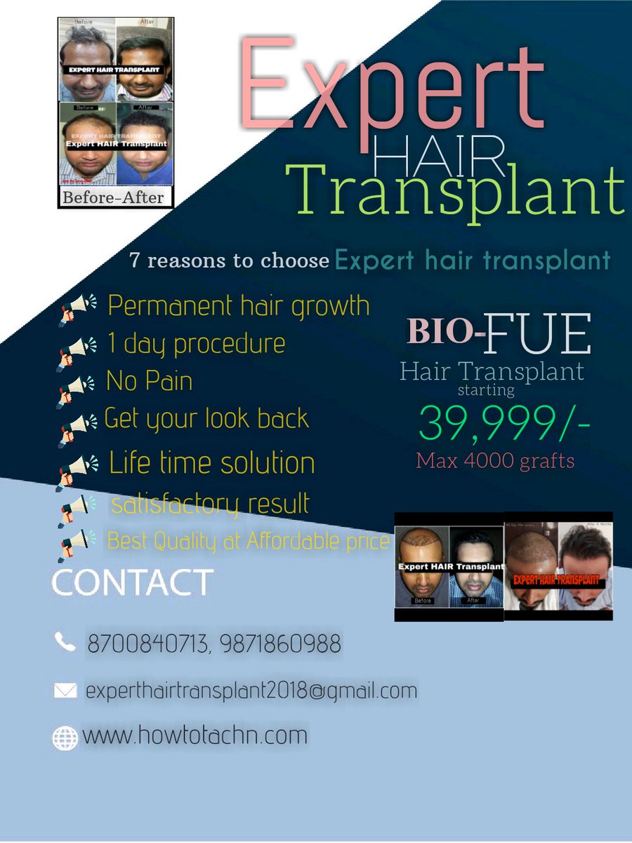 Expert Hair Transplant, Hair & scalp clinic (@HairNcr) / Twitter Expert Hair Transplant, Hair & scalp clinic (@HairNcr) / Twitter
