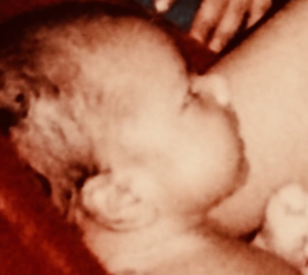 1 Mayıs 2003 Bingöl depreminde hayatlarını kaybeden sevgili evlatlarım {Ferhan Ceylan/ Esra Nur/ Said Kadir Aksa } 16.Vefat yıldönümlerinde büyük bir acı ve hasretle yad ederim.Evlatlarımızla birlikte vefat eden tüm hemşehrilerimize ALLAH’tan rahmet, ailelerine sabır niyaz ederim