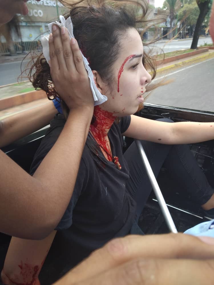 TVVnoticias's tweet photo. #30Abr Reportan dos heridos más tras represión de la GNB en El Trigal, estado Carabobo. Foto cortesía: #TVVNoticias #TVVenezuela https://t.co/lKUYML2ueP