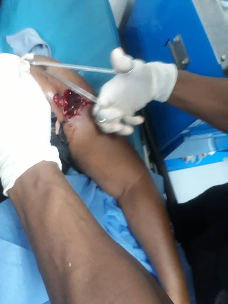 ElyangelicaNews's tweet photo. #ADVERTENCIA Estas imágenes pueden herir su sensibilidad. Corresponden a manifestantes, aproximadamente 100 personas que apoyaban el llamado de @jguaido en el estado Vargas, específicamente en la plaza “El Cónsul” #30Abr https://t.co/RaVlIDME6m