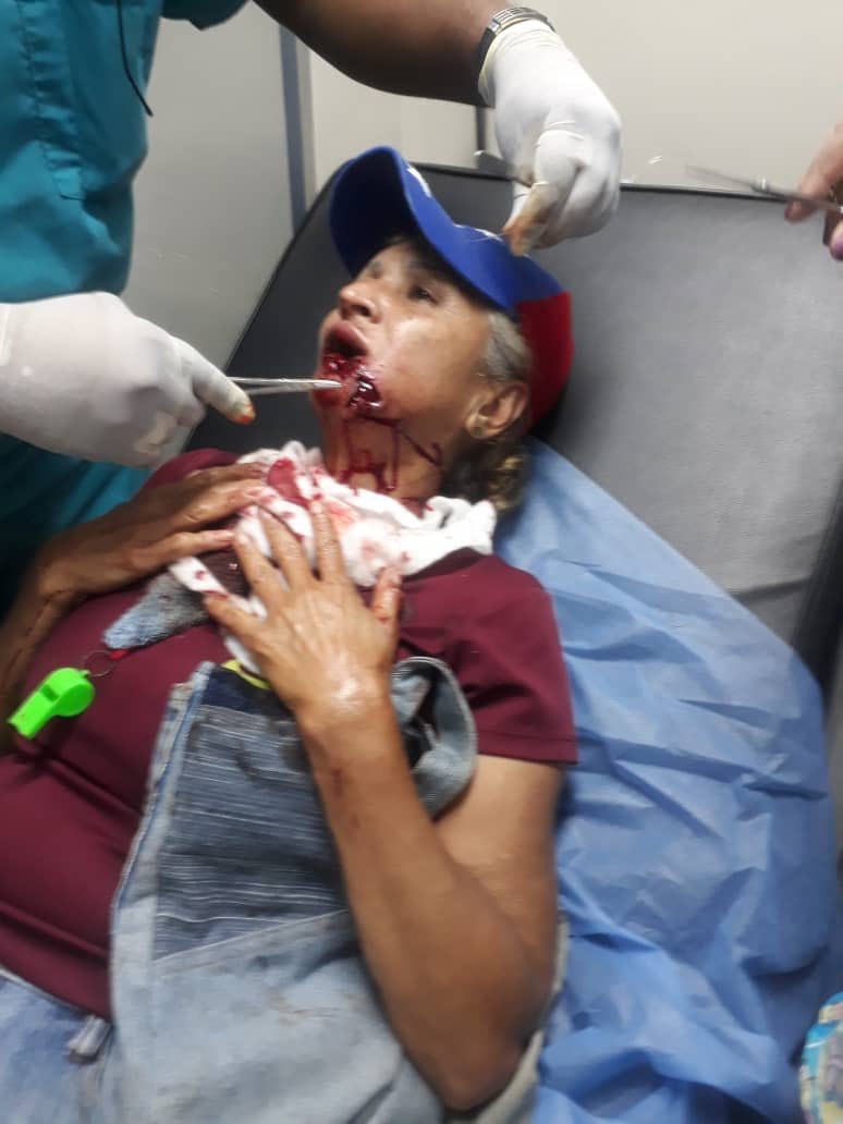ElyangelicaNews's tweet photo. #ADVERTENCIA Estas imágenes pueden herir su sensibilidad. Corresponden a manifestantes, aproximadamente 100 personas que apoyaban el llamado de @jguaido en el estado Vargas, específicamente en la plaza “El Cónsul” #30Abr https://t.co/RaVlIDME6m