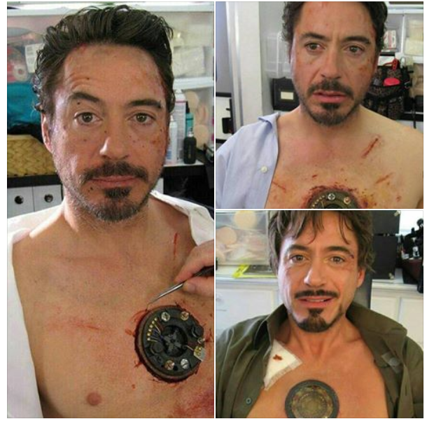 Cet homme souffre d'une maladie grave et rare qui affecte le cœur et a besoin d'équipements pour survivre. À chaque RT, Twitter donnera 50 cents pour l'aider. Partagez et aidez-le. #SiCestSurInternetCestQueCestVrai