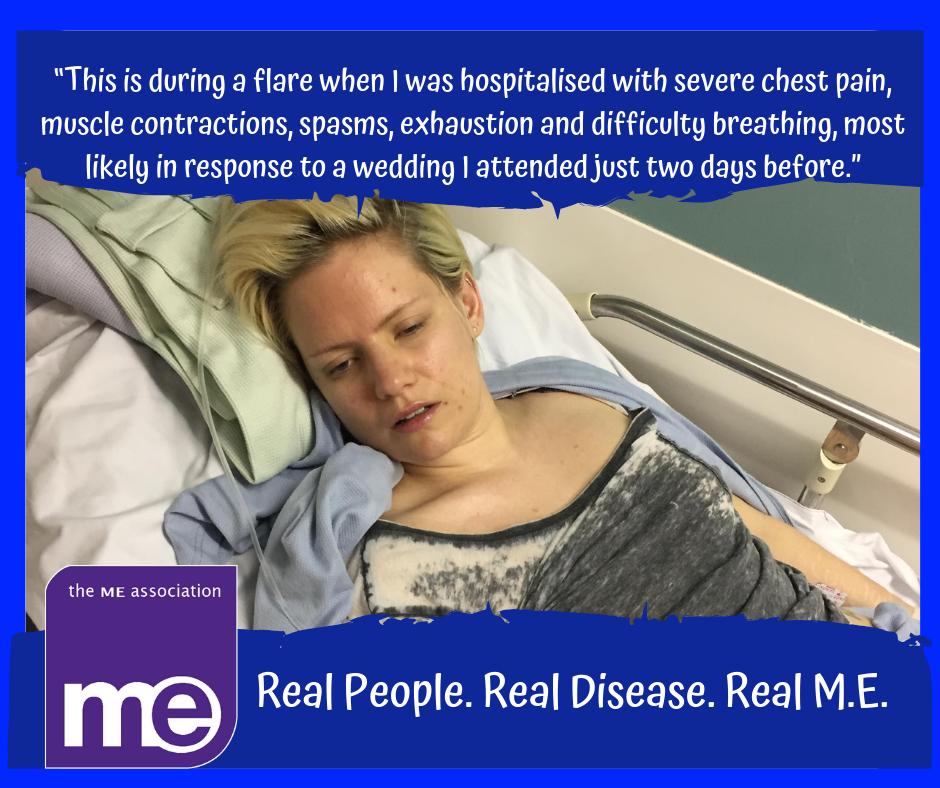 MEAssociation's tweet photo. The REAL M.E.

“This is during a flare when I was hospitalised with severe chest pain, muscle contractions, spams, exhaustion and difficulty breathing, most likely in response to a wedding I attended just two days before.”

https://t.co/LUHPkiDl1S

#MEAW2019 #TheRealME #GoBlue4ME https://t.co/urTv2lPank