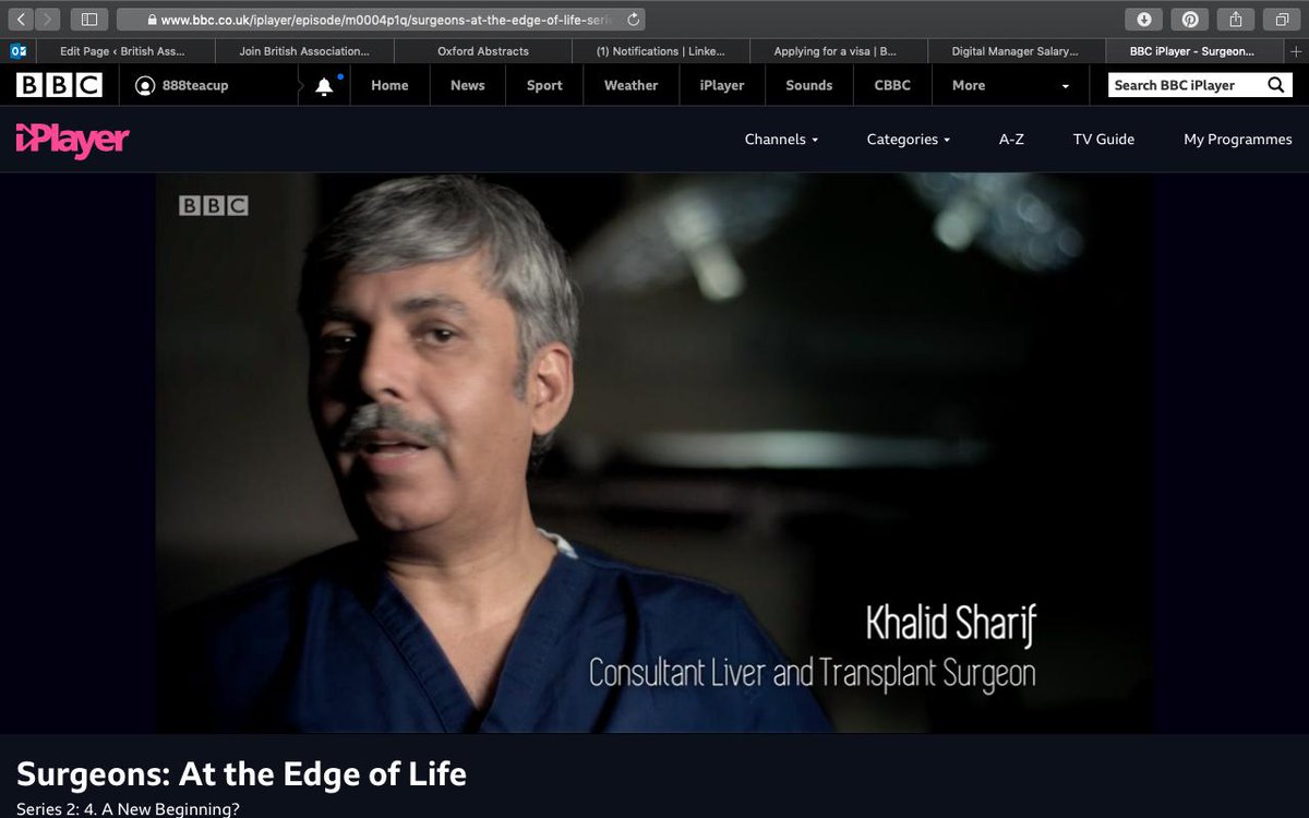 Baps Baps1953 Bapusurgeons Liam Mccarthy Khalid Sharif Show Incredible Teamwork When Transplanting Father S Kidney Into 2 Year Old Isaac In The c S Surgeons At The Edge Of Life Watch Baps Baps1953 Bapusurgeons Liam Mccarthy Khalid Sharif Show Incredible Teamwork When Transplanting Father S Kidney Into 2 Year Old Isaac In The c S Surgeons At The Edge Of Life Watch