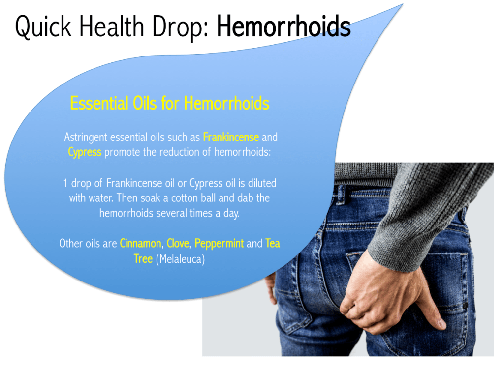 IrelandOils's tweet photo. Quick Health Drop: Essential Oils for Hemorrhoids https://t.co/T3ifNvBV8M https://t.co/InmqRDj3uJ