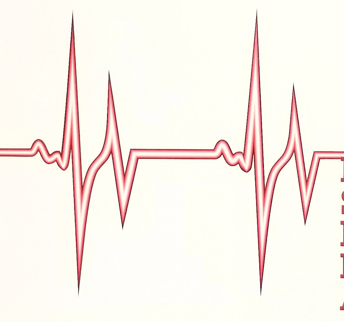 CaldwellSchoolSystem (@caldwellvoice) on Twitter photo Free EKG cardiac screenings this month for all high school athletes, to include rising freshmen. #HeartHealth <a href="/SouthCaldwell1/">South Caldwell High</a> <a href="/gohibriten/">Hibriten Panthers</a> <a href="/west_caldwell1/">West Caldwell High School</a> <a href="/blueridgeemc/">blueridgeemc</a> Free EKG cardiac screenings this month for all high school athletes, to include rising freshmen. #HeartHealth <a href="/SouthCaldwell1/">South Caldwell High</a> <a href="/gohibriten/">Hibriten Panthers</a> <a href="/west_caldwell1/">West Caldwell High School</a> <a href="/blueridgeemc/">blueridgeemc</a>