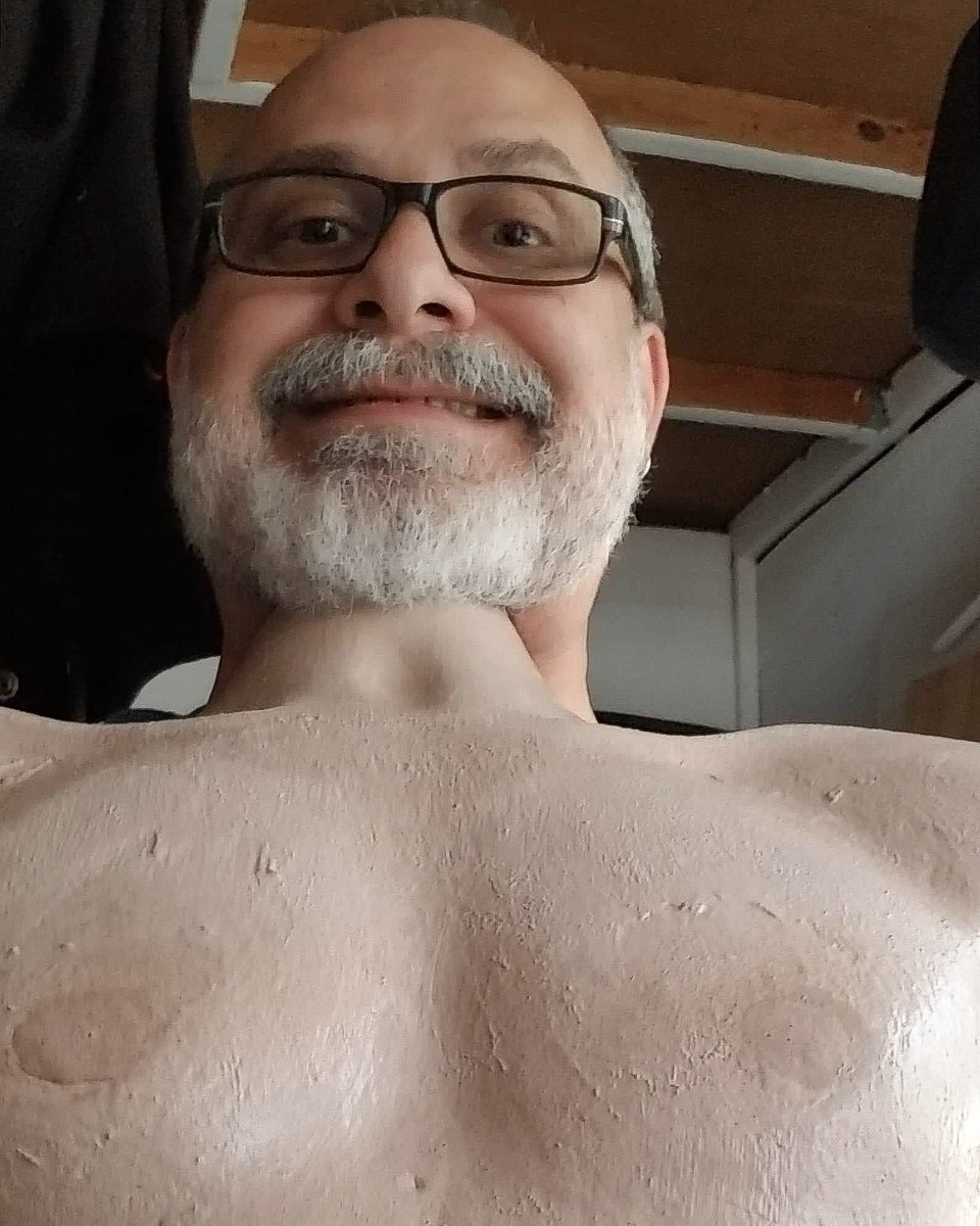 GaneshaWorks's tweet photo. @A2ron42 created #practicaleffect for Scare Tactics #horror #shortmovie shoot. Ala #videodrome by #davidcronenberg This poor torso is about to give up its guts!
.
#filmmaking #indiefilm #indiehorror #horrordirector #scarymovies #filmmaker #moviemaking #lowbudgetfilm https://t.co/Ucp7a3jqWv