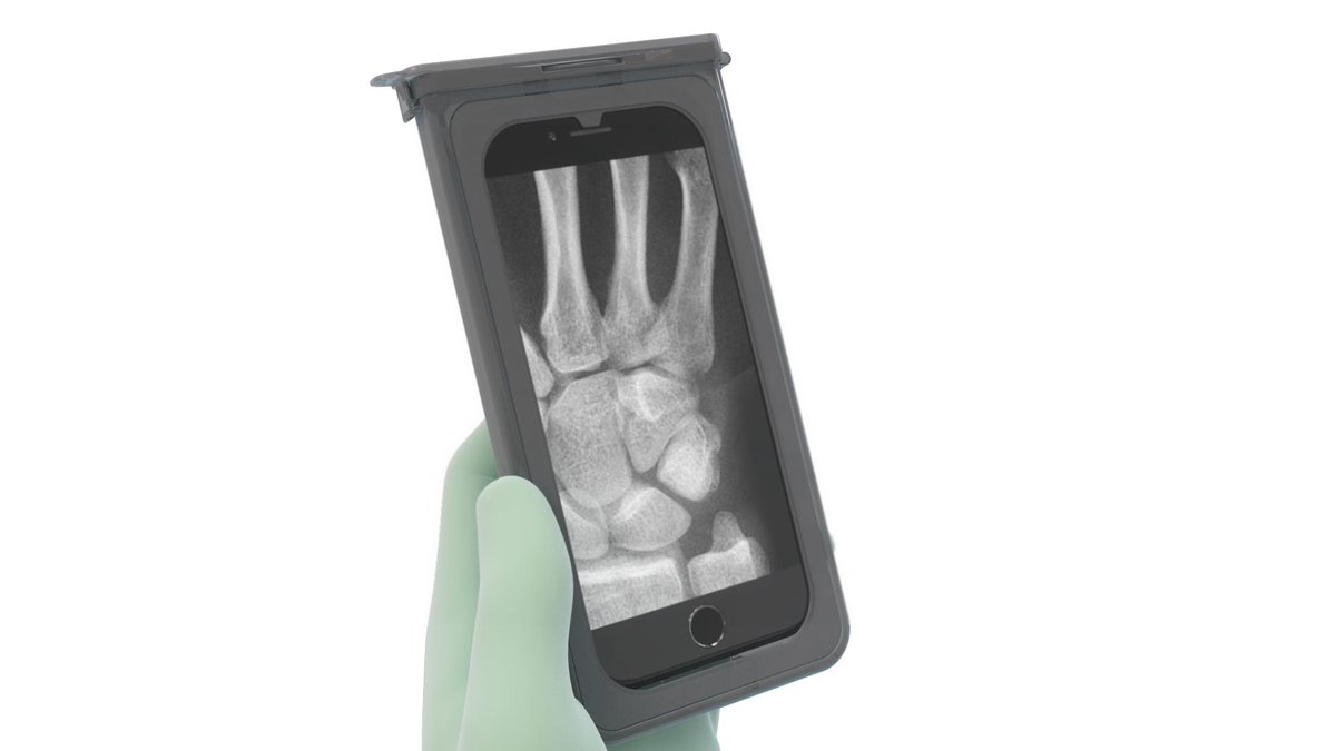 MSU_Osteopathic's tweet photo. #MSUCOM student Rob Zondervan officially launched CleanCase, the first device-specific, fully FDA-compliant product that allows surgeons to safely bring mobile devices into the sterile surgical field. Great work, Rob!  https://t.co/ExfLPC61YJ #SpartansWill https://t.co/9EwEtTK5n9