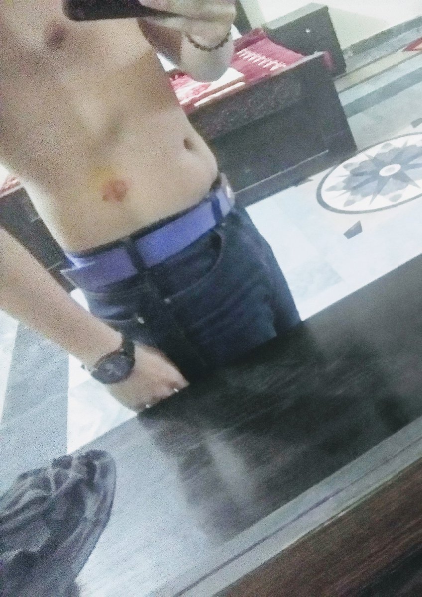 I love pain because it's help to mitigate regret of your lost 😎♥️