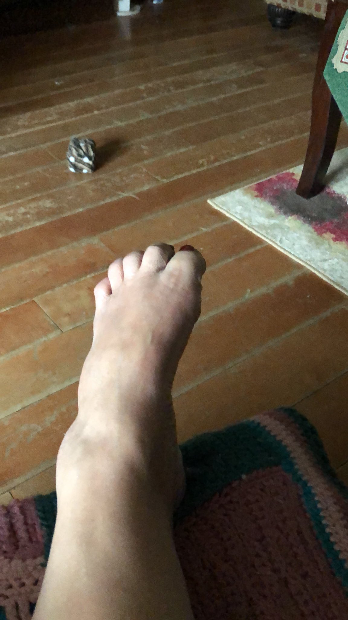 Why do toes curl