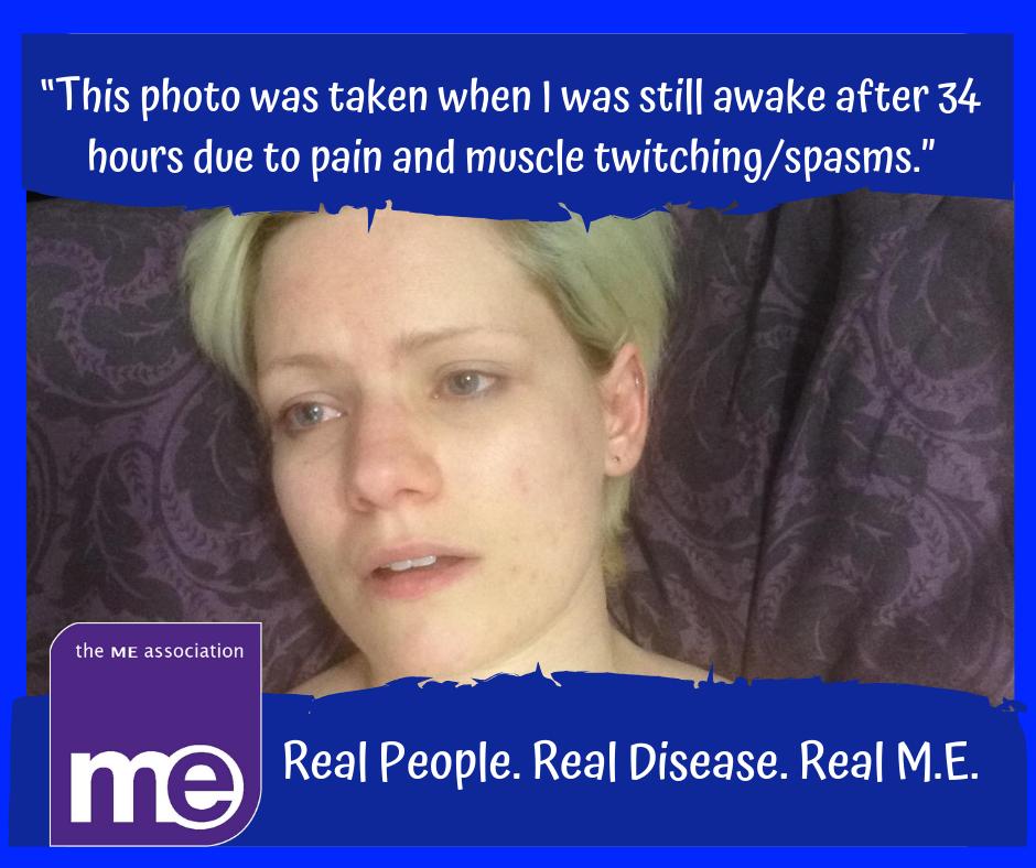 MEAssociation's tweet photo. “This photo was taken when I was still awake after 34 hours due to pain and muscle twitching/ spasms”.

Help us continue raising awareness and facilitating change by sharing these posts and donating to our #GoBlue4ME campaign: https://t.co/LUHPkiDl1S.

#MEAW2019 #TheRealME https://t.co/Rb1XcWD2B1