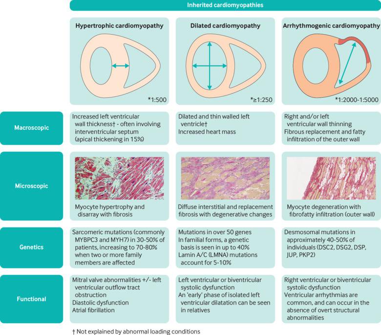 Chris Miles (@drcjmiles) on Twitter photo Inherited cardiomyopathies: read our #ClinicalUpdate in #theBMJ <a href="/bmj_latest/">The BMJ</a> <a href="/BehrElijah/">Elijah Behr</a> <a href="/Zephyzoo/">Zeph F</a> <a href="/DrMaiteTome/">@MTome</a> <a href="/TheBHF/">British Heart Foundation</a> <a href="/CRY_UK/">CRY</a> <a href="/myheart_UK/">myheart</a> <a href="/StGeorgesUni/">St George's, University of London (1752-2024)</a> <a href="/Cardiomyopathy/">Cardiomyopathy UK</a>
bmj.com/content/365/bm… Inherited cardiomyopathies: read our #ClinicalUpdate in #theBMJ <a href="/bmj_latest/">The BMJ</a> <a href="/BehrElijah/">Elijah Behr</a> <a href="/Zephyzoo/">Zeph F</a> <a href="/DrMaiteTome/">@MTome</a> <a href="/TheBHF/">British Heart Foundation</a> <a href="/CRY_UK/">CRY</a> <a href="/myheart_UK/">myheart</a> <a href="/StGeorgesUni/">St George's, University of London (1752-2024)</a> <a href="/Cardiomyopathy/">Cardiomyopathy UK</a>
bmj.com/content/365/bm…