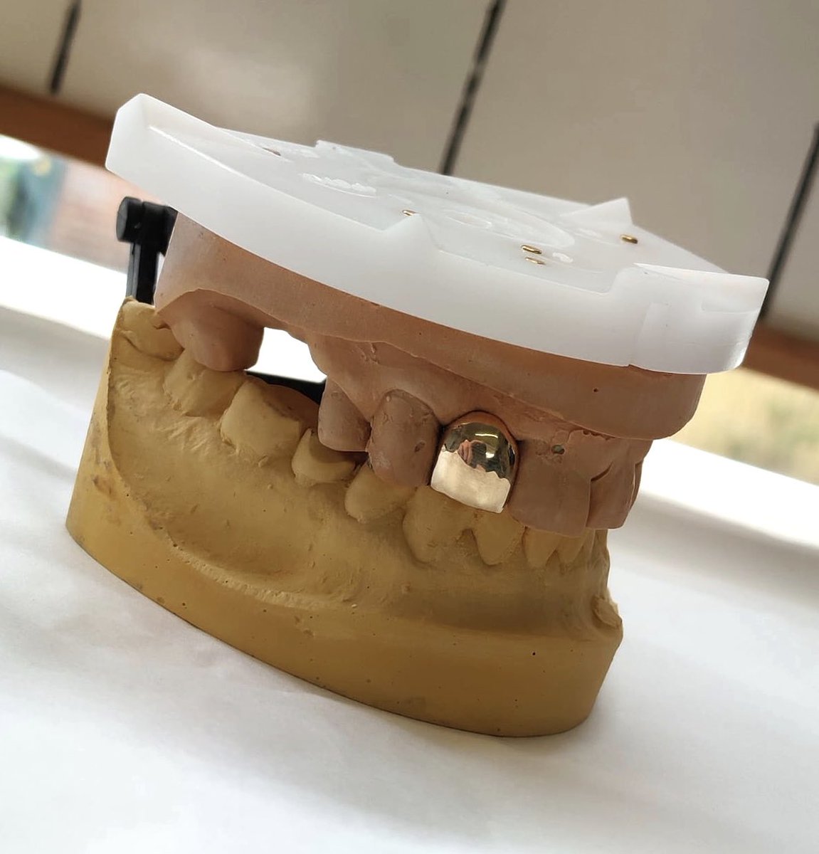 A gold maryland bridge, made by our implant technician Malcolm! 🔬#gold  #maryland #bridge #dentist #dentistry #teeth #tooth 🦷#dentaltechnician  #dentaltech #dentalassistant #dentalhygienist #dentalschool #goldsmith  🙌🏽#picoftheday #instagood ..., image size:1151x1200