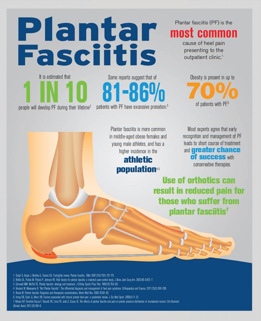#PlantarFasciitis's the most common cause of #heelpain. 1 in 10'll develop it. The use of #orthotics can result in #reducedpain for those who suffer it. Get your appointment today! admin@bowvalleychiro.com #Calgary #calgarydowntown #calgarynortheast #ycc #yccnow #CalgaryNE