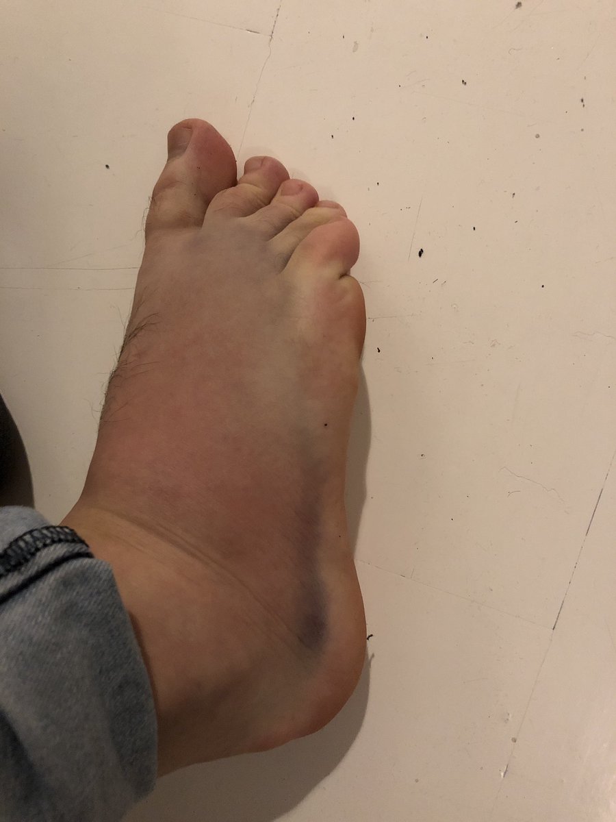 Slipped and almost broke it, the color is not dirt 🙈 Trying to see it positive, more time to work on some guides on AllClash instead of walking around in the sun... ✌️