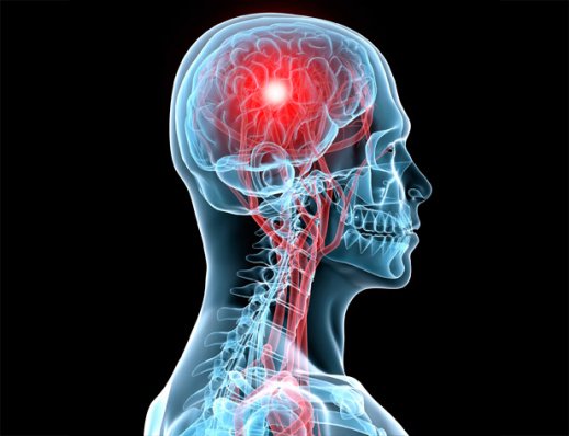 What can cause a stroke? If you have certain medical conditions your more at risk of a stroke: High blood pressure, High cholesterol, Atrial fibrillation, Diabetes, It is important that these conditions are carefully monitored and treated. #makemaypurple #whhstroke