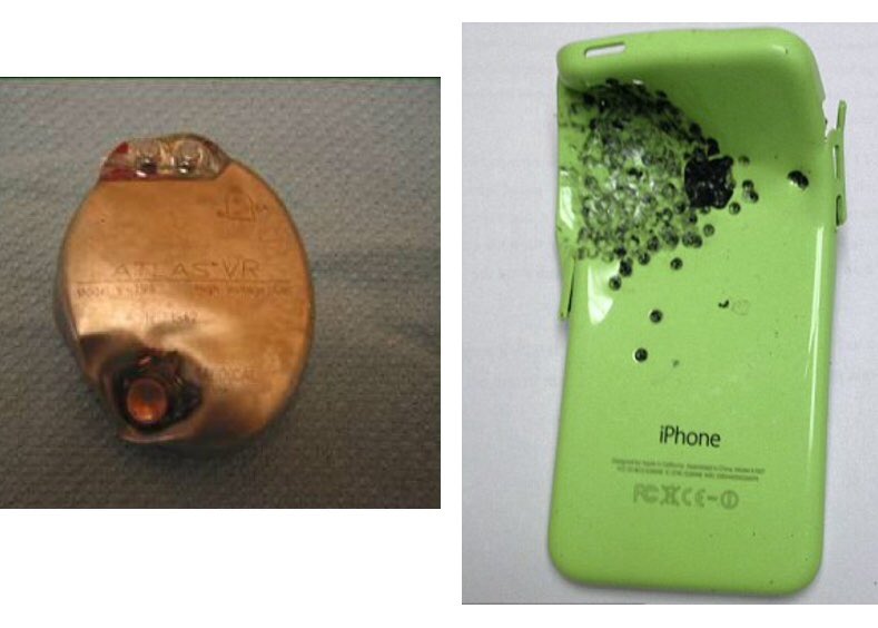 Different way in how ICD can save life 

Next to it is a cheaper way to save life!!! #CardioEd #EPeeps #CardioTwitter #cardiology