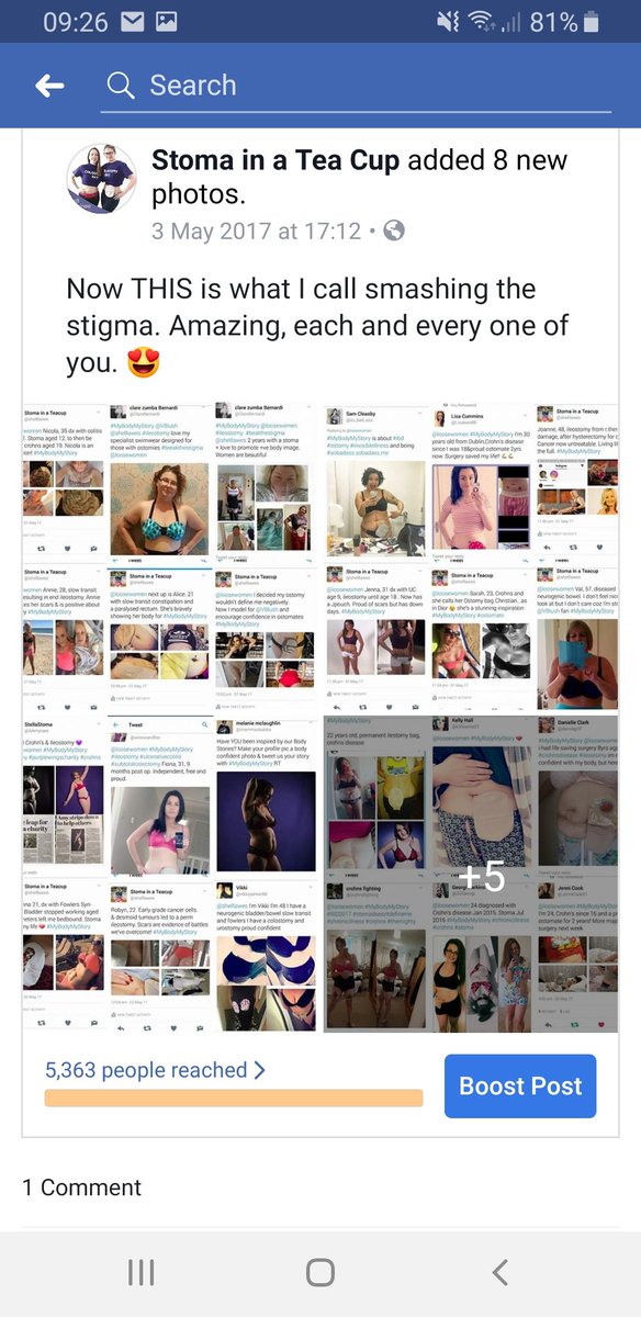 stomainateacup's tweet image. 2 years ago, almost 100 ostomates sent me pics for a body confidence campaign by the @loosewomen. Some images were shared on TV &amp;amp; I was honoured to take part in a shoot with @TheSun after being contacted by @ColostomyUK. 

#removingthestigma #ostomyawareness #ostomy #ostomate