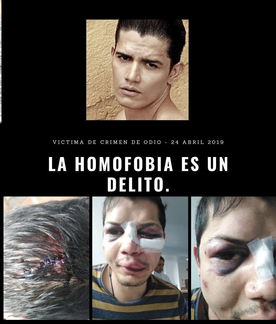 alejomichells's tweet photo. #DENUNCIA nuevo caso de homofobia, abuso policial y discriminación contra un hombre homosexual en la localidad de la Candelaria, solicitamos difundir esta información a fin de establecer la responsabilidad de la Policía en estos hechos. #NoALaHomofobia https://t.co/06DEaSUfVQ