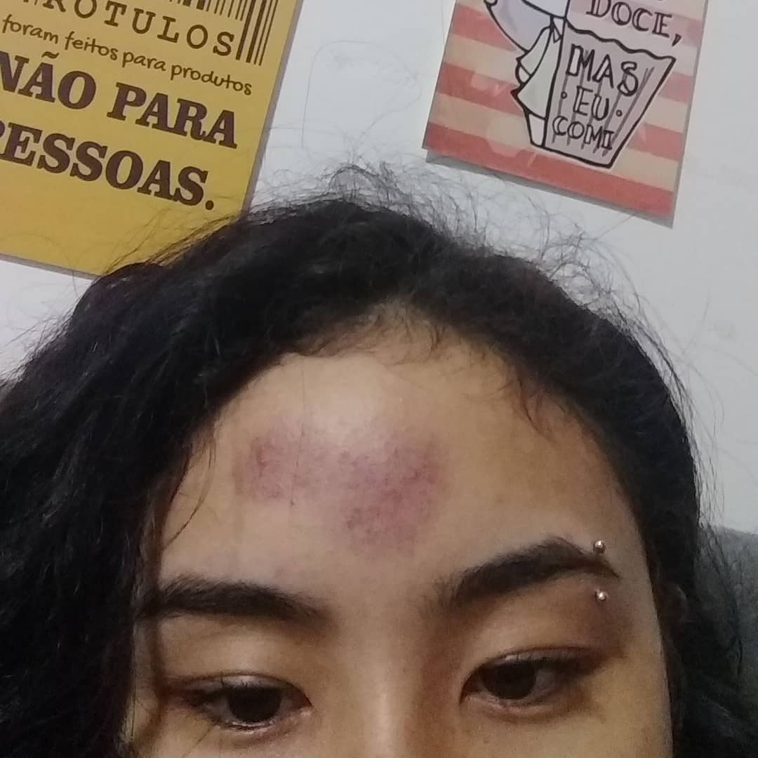 misangria's tweet photo. #turmafeirafu eu e meu amigo decidimos "brincar de unicórnio" com essas flechas e minha testa ficou roxa por uma semana https://t.co/M4JKqrB1Kb