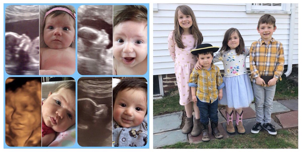 Our four babies, inside the womb, a little after birth, and now. Since the moment of conception, it was them — their unique DNA was there. At every stage of life, it is them. Human from the start, and always possessing innate, incalculable worth. Let babies live.  #AliveFromNY