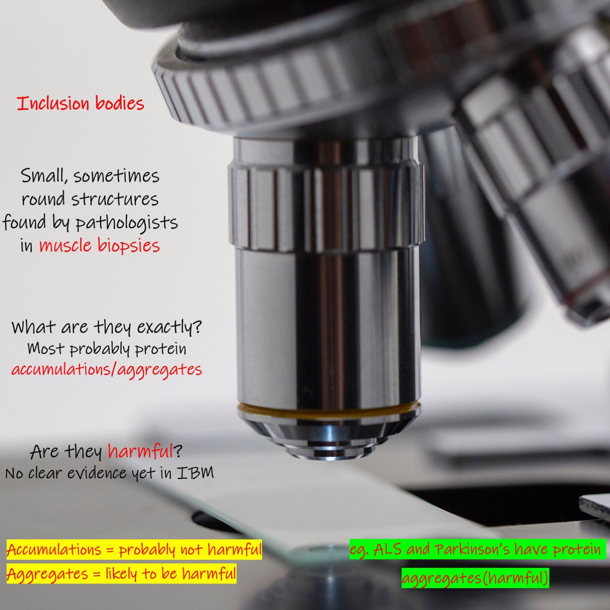 Inclusion body Myositis, where does the name come from? #myositisawareness #myositisresearcher #AcademicTwitter #inclusionbodymyositis