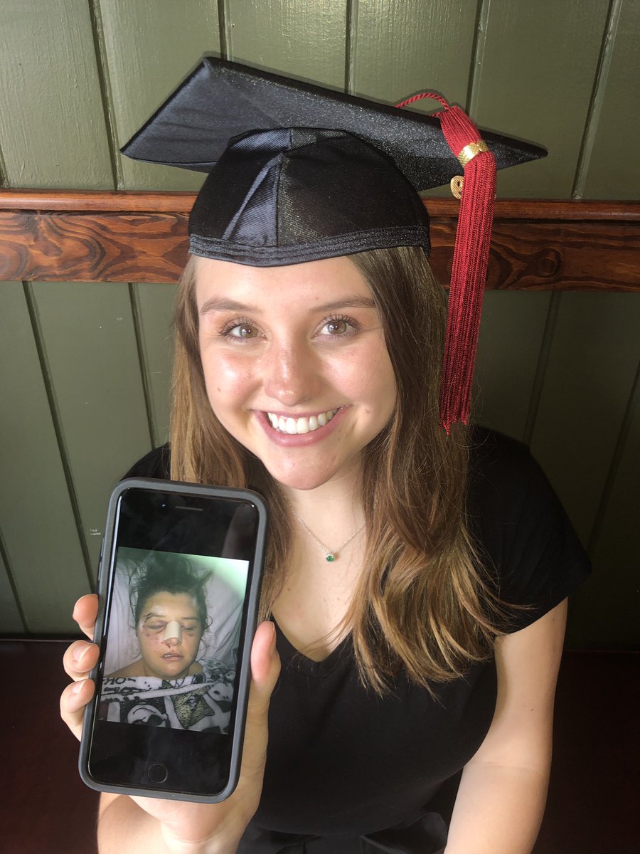 tarantrashby's tweet photo. “With every broken bone, I swear I lived.” 

Despite the shattered bones and chipped teeth, I’ve had the best four years of my life at Ohio University. I DID THAT. https://t.co/mcfjClReng