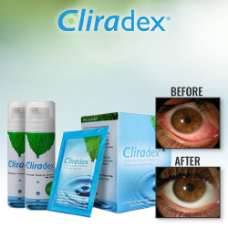 websesame's tweet photo. How to get natural relief for dry, itchy and irritated eyes https://t.co/aoIO3oh4YV
#health #natural #eyes #dryeyes #itchyeyes #bestoftheday #HyperRTS #twitchsharing #traffup #lovingblogs #femalebloggerrt #a1supplements #retweetplease https://t.co/AlAOUQQAky