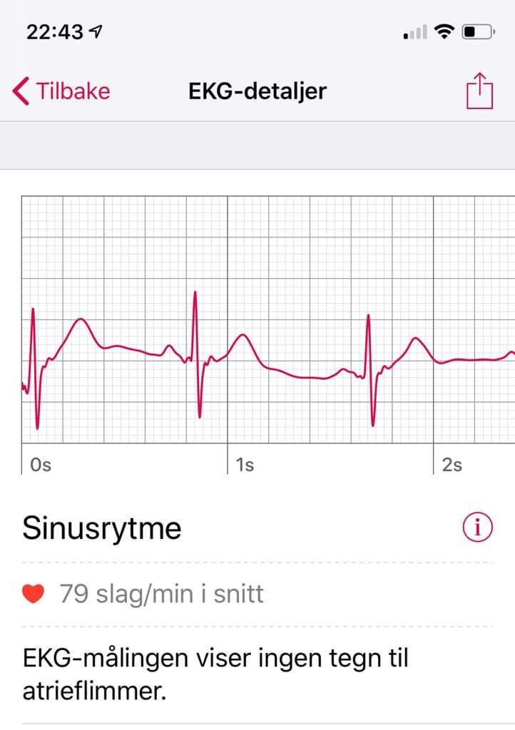 Liverpuls på 2-2... #2pl #lfc