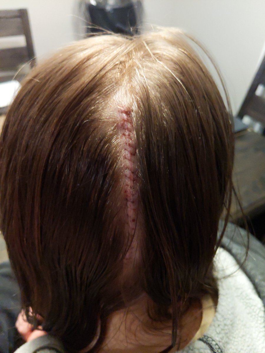 norris_buffalo's tweet photo. @kwilli1046 My hair is the least of what I've sacrificed for my daughter. She just completed 4 years of college in an honors program with a brain tumor. Your daughter can be whatever she wants to be as long as someone loves her and she never stops trying https://t.co/56uDy0ry9o