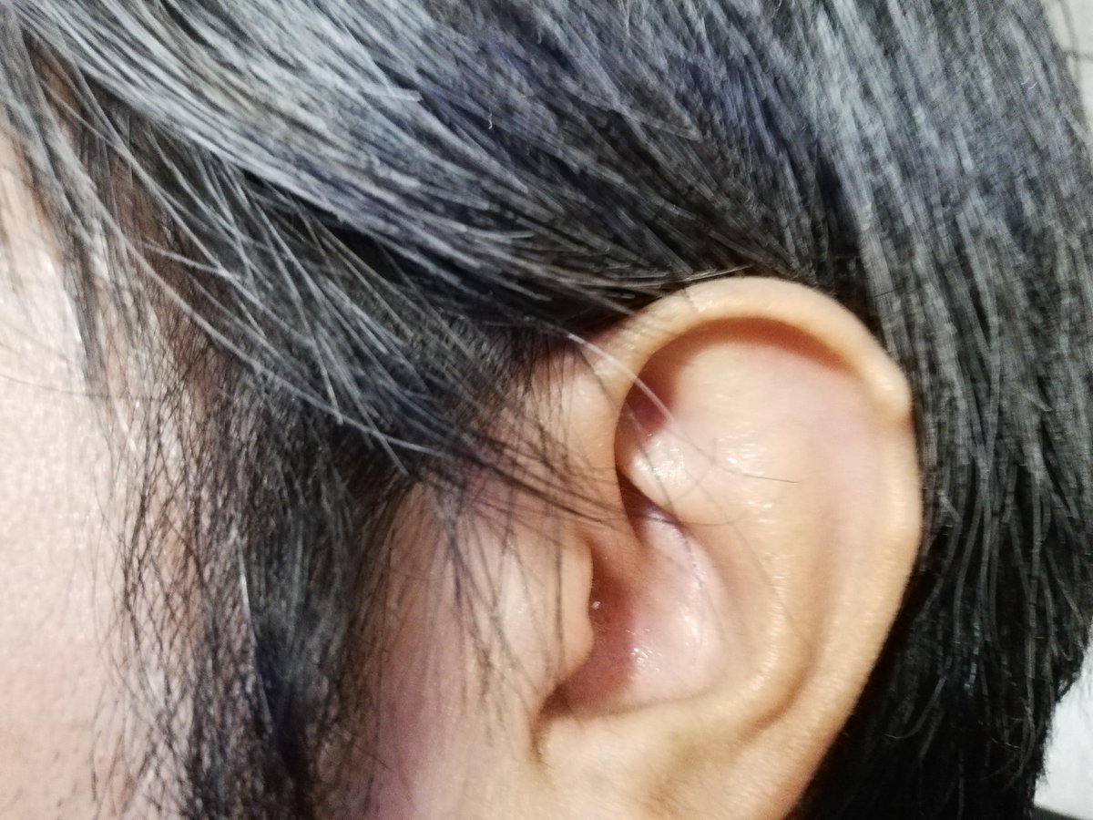 いーある 寒がり على تويتر 俺の耳の突起みたいな形は父親もそうだが 祖父も曾祖父もあったそうだから遺伝子を受け継いでいるらしい 俺は左に父親は右にある 人体遺伝子