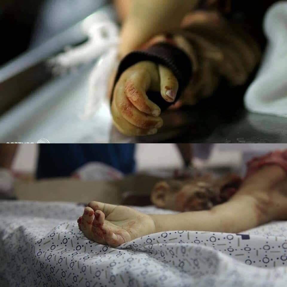AMD4x's tweet photo. A Palestinian woman from #Gaza Strip published a photo and wrote on it:
These fingers of "Seba Abu Arar" looks like my daughter's fingers "Zeina", they had the same age. "Zeina " died while she was playing, during the Israeli #War in 2014.
These pictures keep me up all the night. https://t.co/Yu4lMcMRxu
