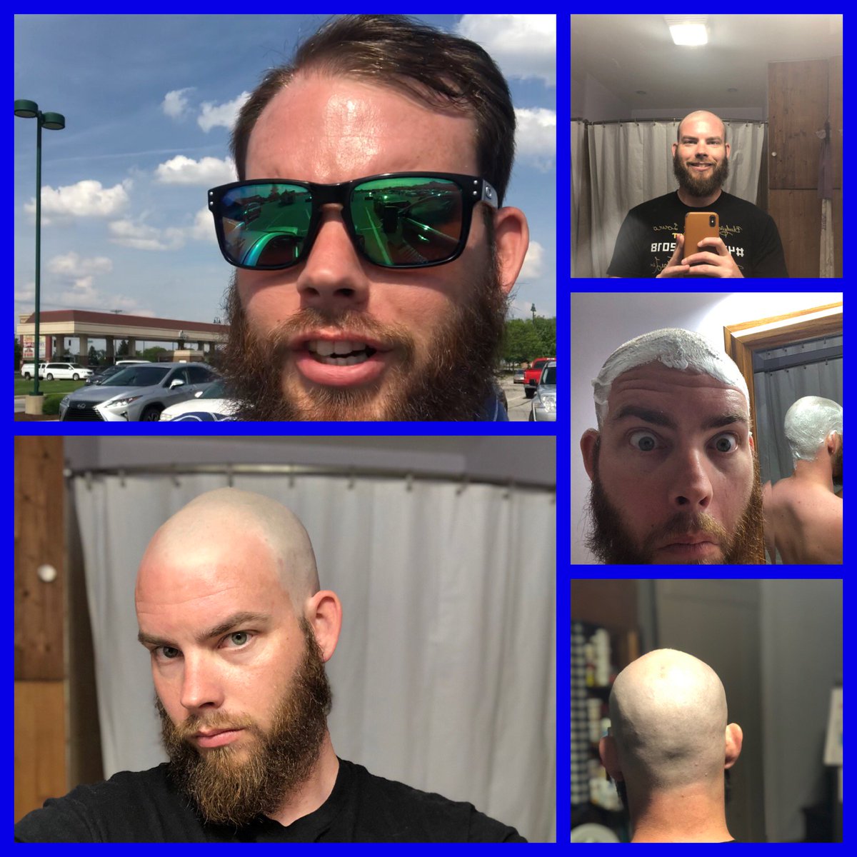 Scomar26's tweet photo. I would like to thank @Lowco2525 and her fantastic community for raising $20000 and counting for @StJudePLAYLIVE .  At 16k I said I would shave my head so here it is in all its glory. If you want to donate go to https://t.co/WHxGzL5314 #ForTheKids #INeedSunscreen https://t.co/ypxMSTg3pu