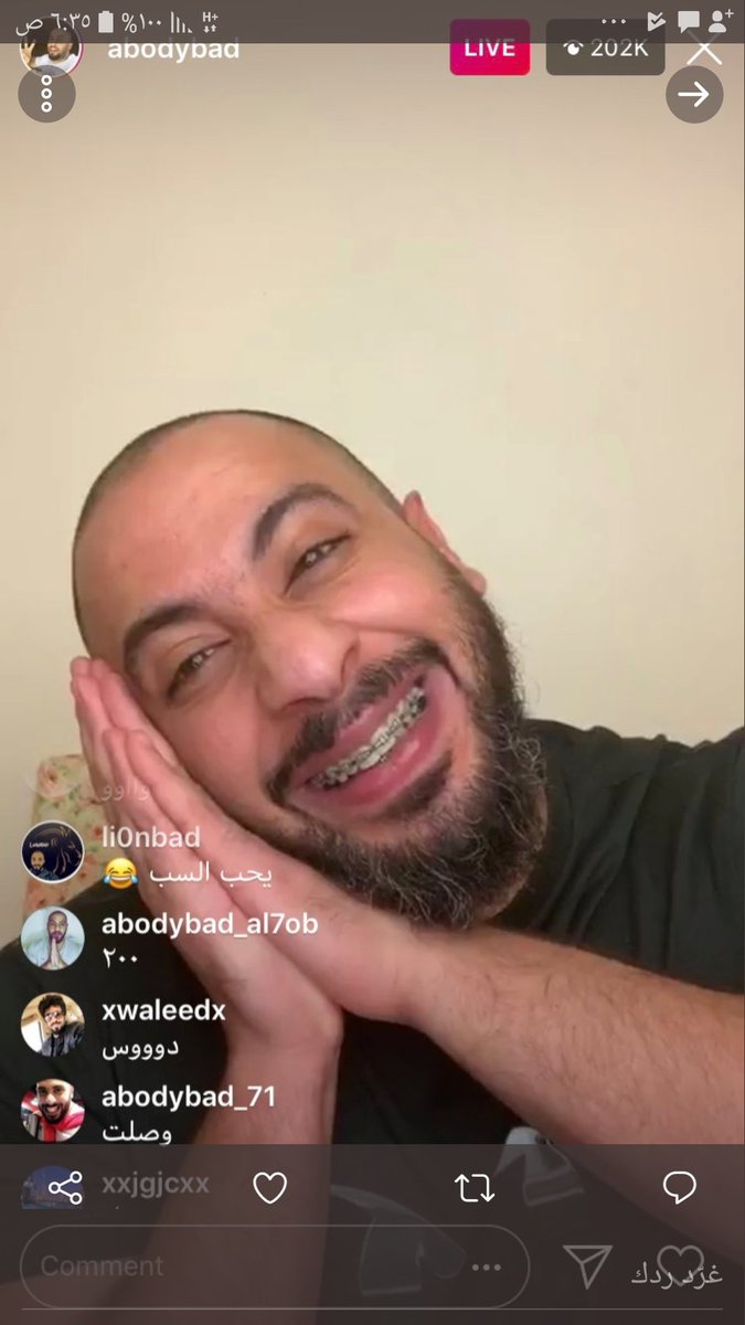 7AWDonjGduhHpPQ's tweet image. #احب_عبودي_باد ايش صار على الطويطريووووون 😂😂😂😂😂