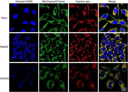Braese <a href="/BraseStefan/">Stefan Bräse</a> and co-workers <a href="/KITKarlsruhe/">Shmoopy</a> report new polyfluorinated #cyanine dyes for selective #NIRstaining of #mitochondria  doi.wiley.com/10.1002/chem.2…