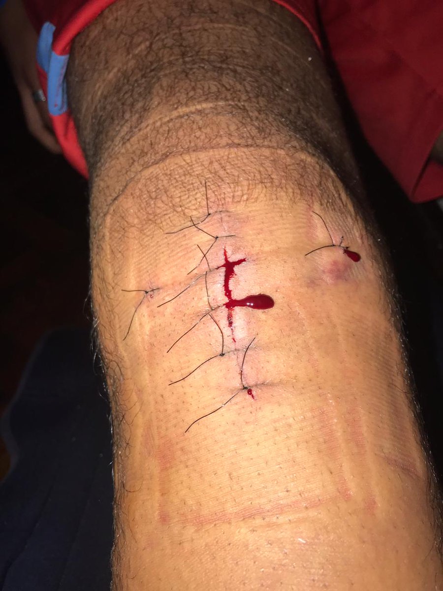 AgustinDip1's tweet photo. Rt para no romperte toda la rodilla xd https://t.co/naEnsin6U8