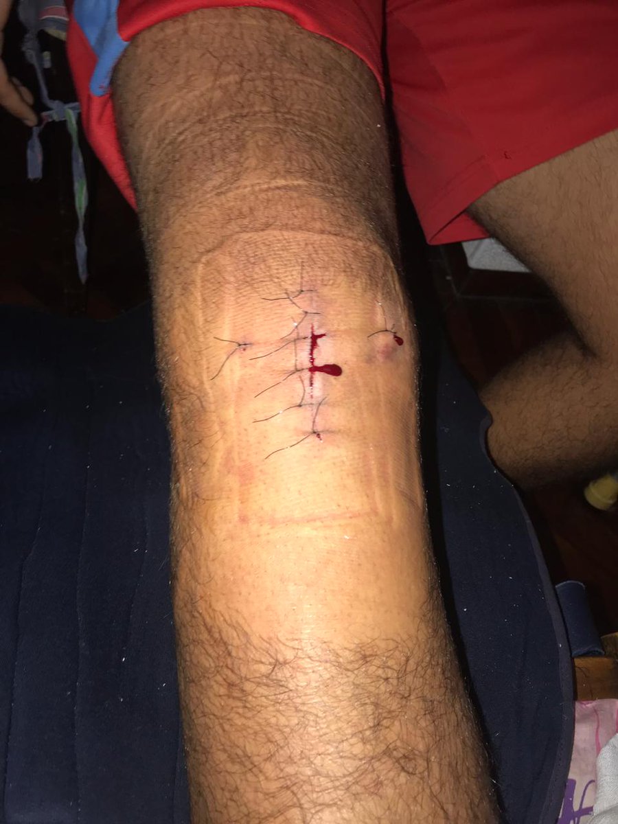 AgustinDip1's tweet photo. Rt para no romperte toda la rodilla xd https://t.co/naEnsin6U8