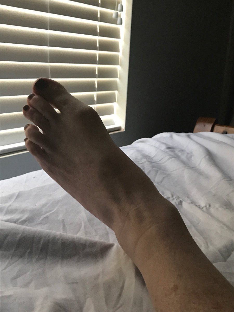 bellablueyes1's tweet photo. Iβll post a picture of my foot #ToProveIAmNotABot https://t.co/Sq4SwbKstu