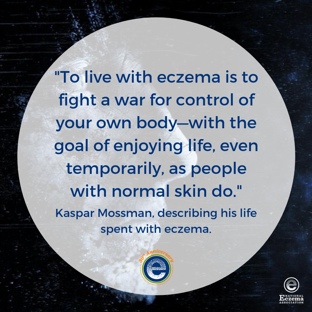 nationaleczema's tweet photo. Kaspar Mossman sums up life with #eczema. via #livingwithitch by Dr Gil Yosipovitch.
Read more: https://t.co/O3Xfxbgxy6
#eczemawarrior #itchingforacure #eczemalife #unhideeczema https://t.co/1XGbGWqR6f
