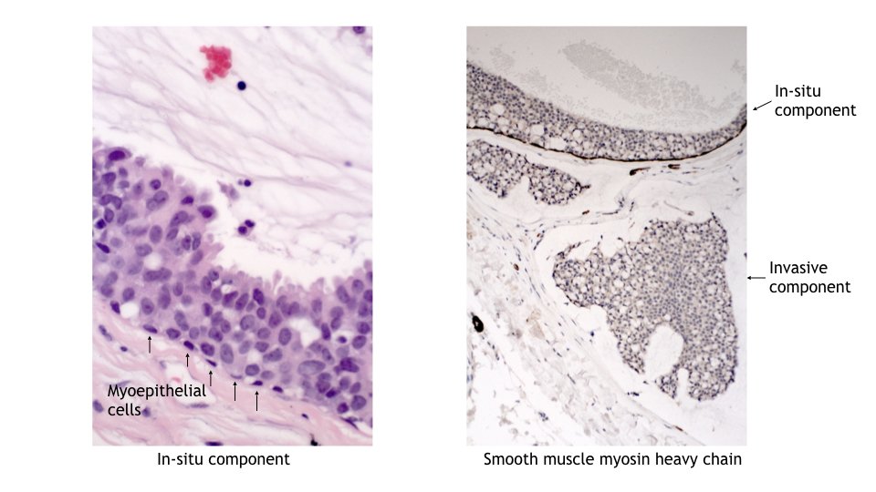 MBBS_Pathology tweet picture