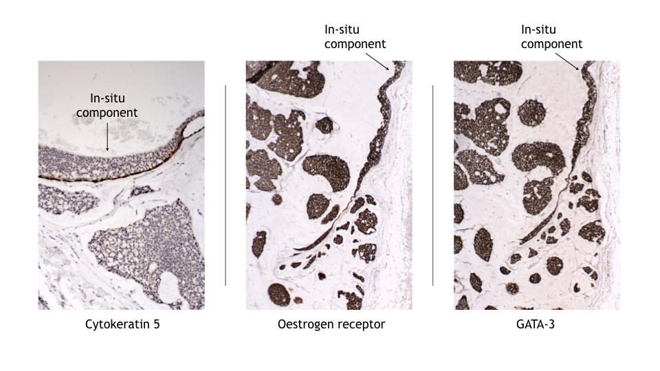 MBBS_Pathology tweet picture