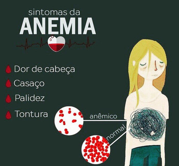 profbbasilio's tweet image. Fiquem de olho! Vocês ou pessoas próximas podem estar passando por condições de anemia. 

#saude #anemiaferropriva #anemiafalciforme #doenca #educacaofisica #edfisica #personaltrainer #caruaru