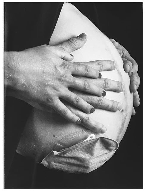 CrohnColitisNL's tweet photo. Ondanks alle ‘shit’ de kunst van het leven nooit opgegeven en het mooiste mogen ervaren dat er is - Engelien #IBDlevenskunst #wereldIBDdag https://t.co/ifj62QdtTF